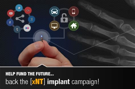 xnt nfc tag|The xNT implantable NFC chip .